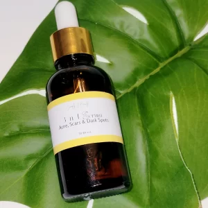 3-n-1 Serum (Acne, Scars & Dark Spots)